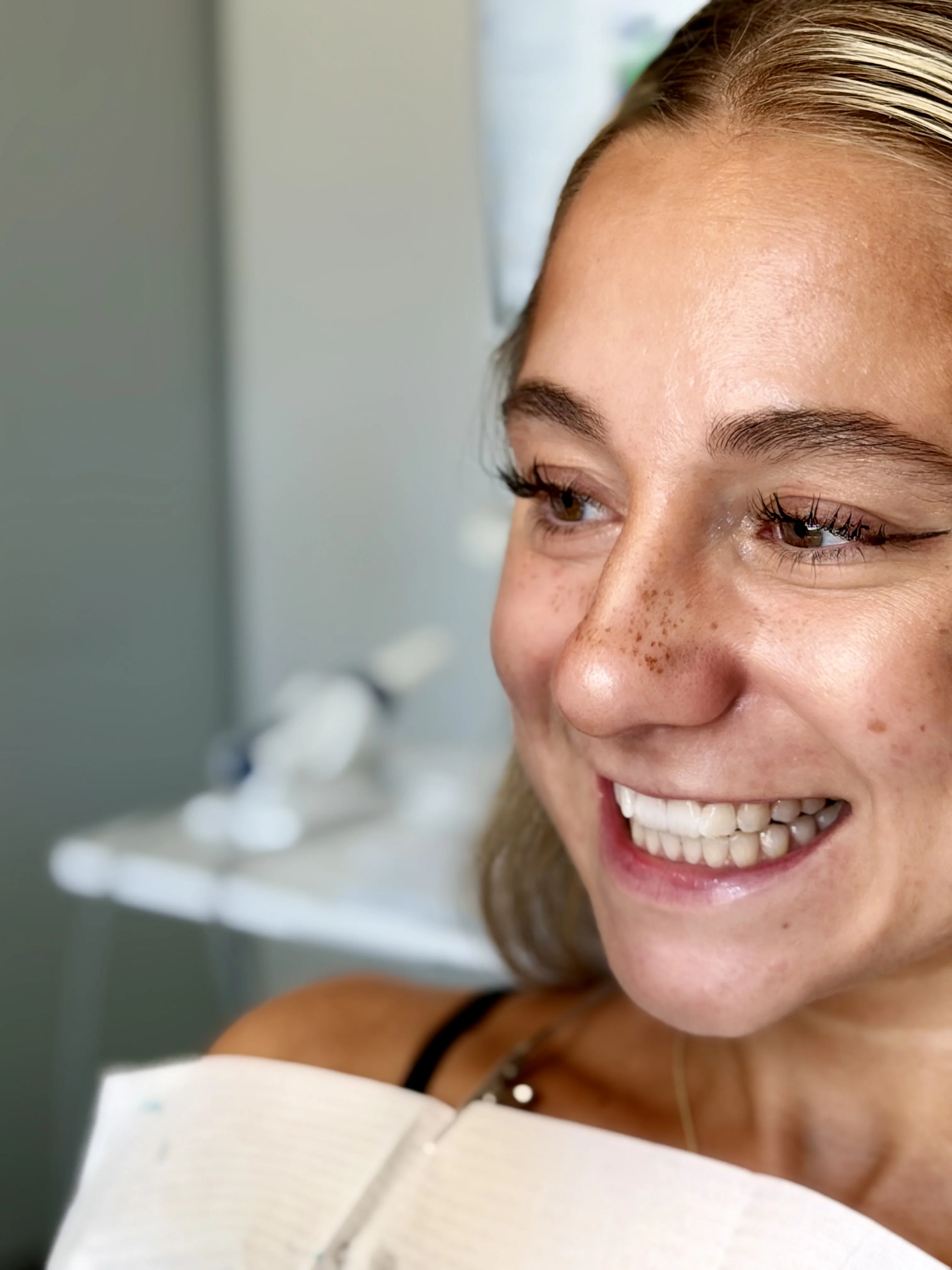 Strahlendes Lächeln nach Bleaching